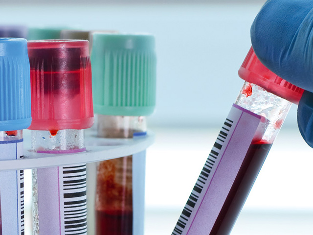 Blutproben in beschrifteten Röhrchen mit Barcodes im Labor